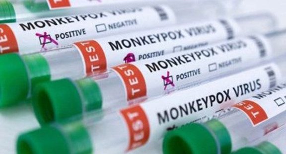 EU cấp phép sử dụng vaccine của Bavarian Nordic phòng đậu mùa khỉ